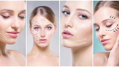 chirurgie-plastique-femme-schema
