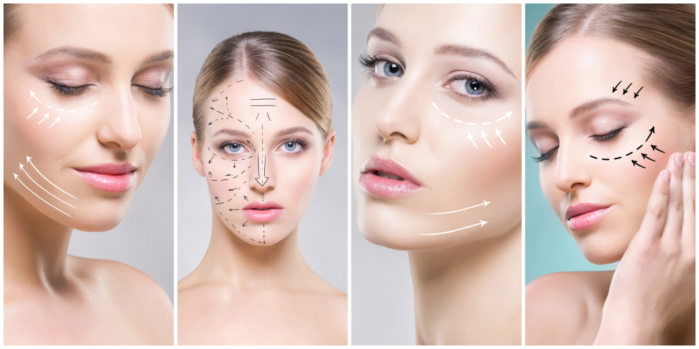 chirurgie-plastique-femme-schema